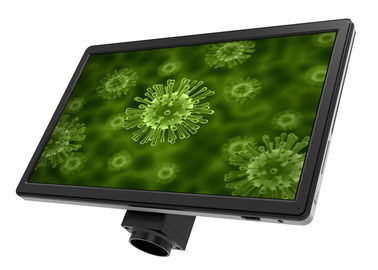 China Negro completo de la pantalla LCD UOP XSP-16.0 de los accesorios del microscopio de la P.M. de HD 16 proveedor